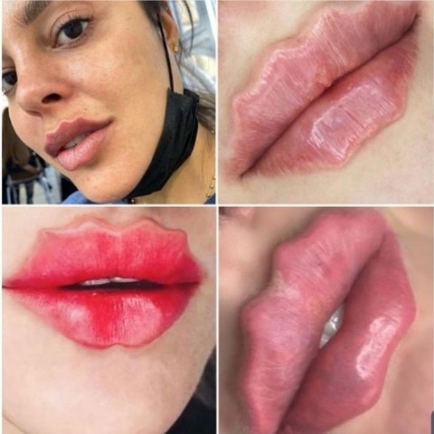 Ada Cewek Yang Mau Coba? Trend Bibir Keriting, Seksi Tapi Terlihat Aneh