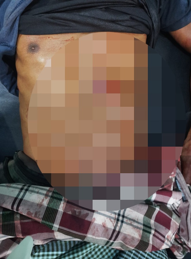 Anak Pembunuh Bapak Kandung di Luwu Ternyata Pernah Dipenjara Kasus Narkoba