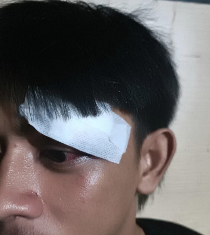 Aniaya Rekan Bisnisnya, Lurah Tomoni Lutim Dipolisikan